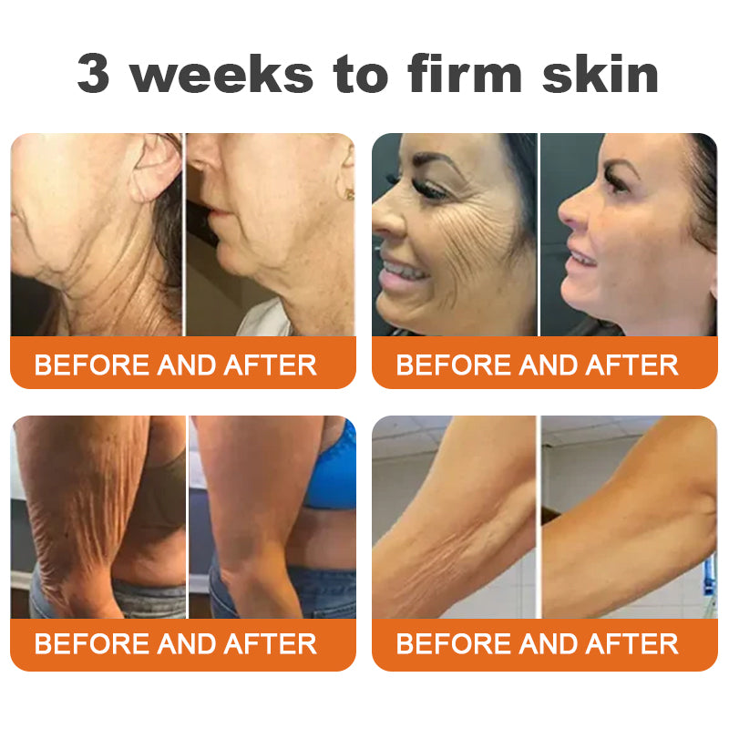💎✨✨Made and Shipped from Australia✨Flysmus™ Botox Bee Venom Firming Serum Stick🔥LAST DAY 70% OFF
