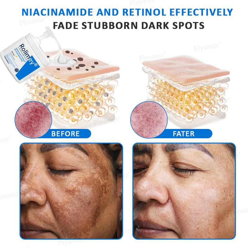 💎✨✨(Made and Shipped from Australia)✨Rolimey® Advanced Firming & Wrinkle-Reducing Cream (with SPF 50+)✨LAST DAY 60% OFF