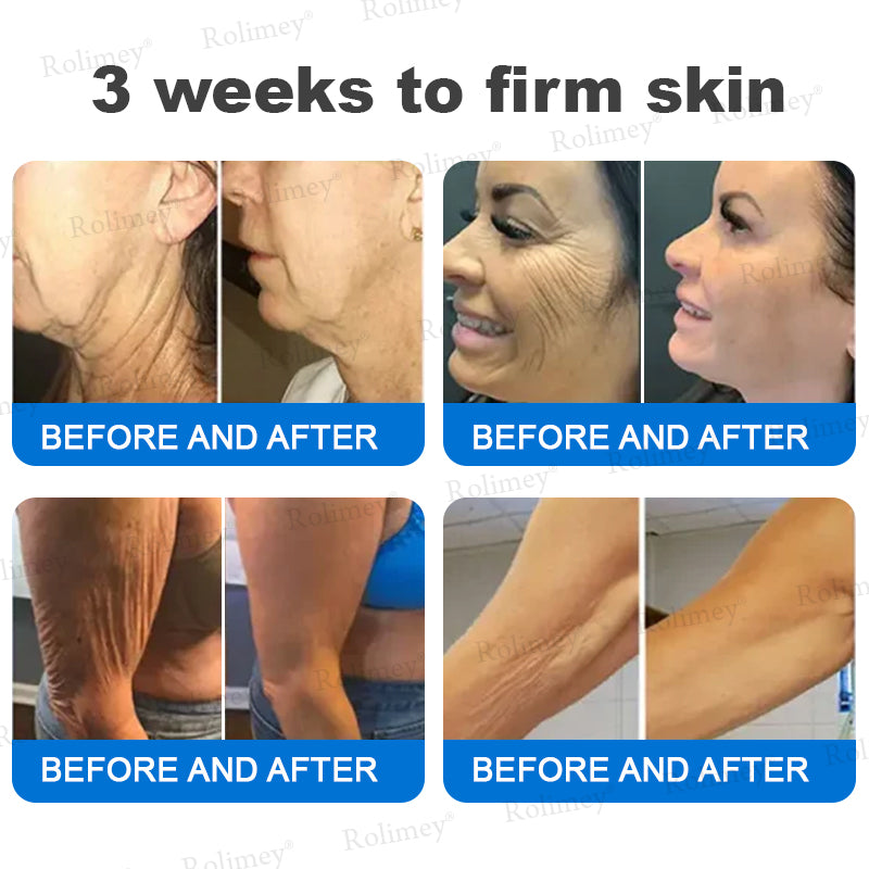 💎✨✨(Made and Shipped from Australia)✨Rolimey® Advanced Firming & Wrinkle-Reducing Cream (with SPF 50+)✨LAST DAY 60% OFF