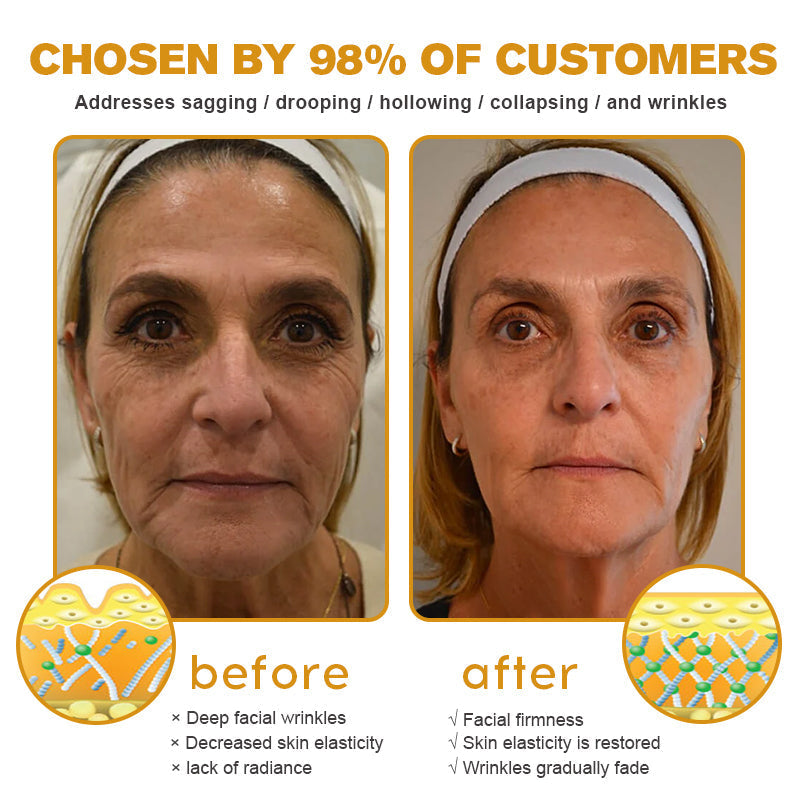 (✨💎💎Made and Shipped from Australia)✨ Furzero™ Botox Bee Venom Wrinkle Removal Cream- LAST DAY 70% OFF