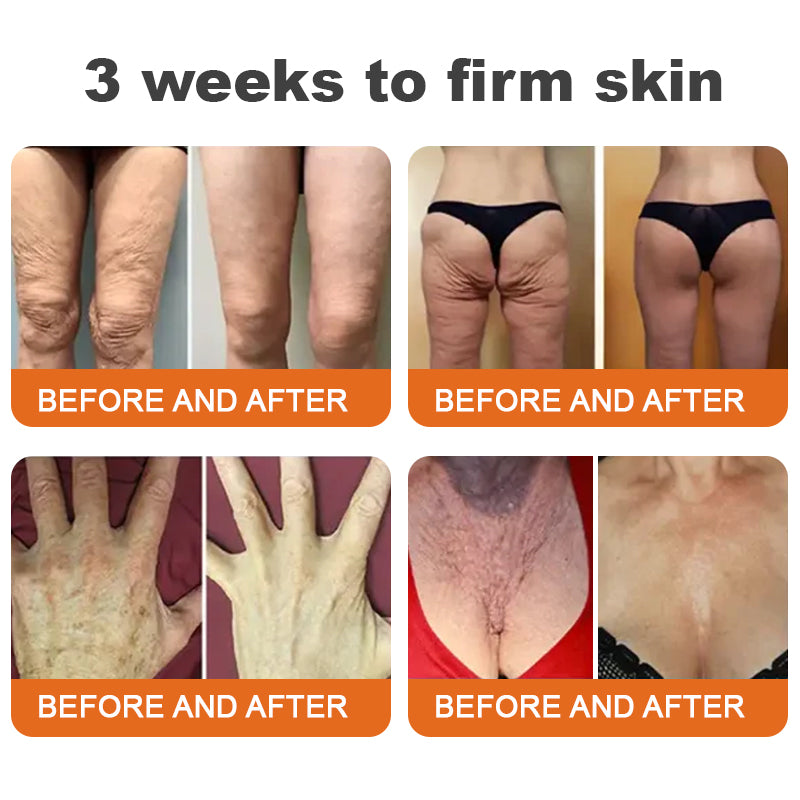 💎💎👩‍🔬Made and Shipped from Australia✨Flysmus™ Botox Bee Venom Firming Serum Stick🔥LAST DAY 70% OFF