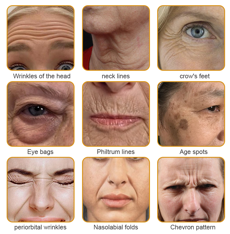 (👩‍🔬✨✨Made and Shipped from Australia)✨ Furzero™ Botox Bee Venom Wrinkle Removal Cream- LAST DAY 70% OFF