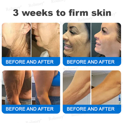 💎✨Made and Shipped from Australia)✨Rolimey® Advanced Firming & Wrinkle-Reducing Cream (with SPF 50+)✨LAST DAY 60% OFF