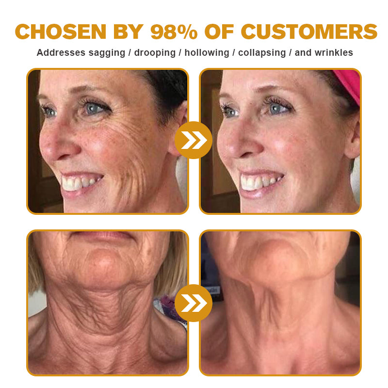 (👩‍🔬✨✨Made and Shipped from Australia)✨ Furzero™ Botox Bee Venom Wrinkle Removal Cream- LAST DAY 70% OFF
