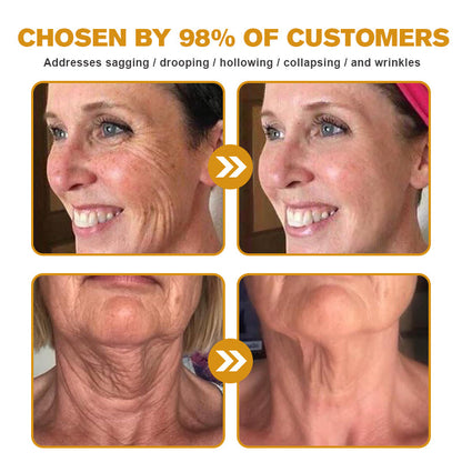 (👩‍🔬✨✨Made and Shipped from Australia)✨ Furzero™ Botox Bee Venom Wrinkle Removal Cream- LAST DAY 70% OFF